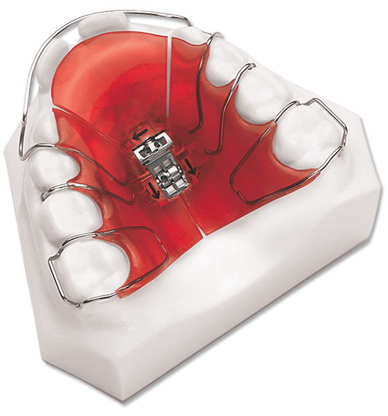 Removable Orthodontic Appliances Coastal Dental Group